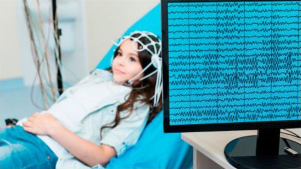 Evaluación de exámenes neurofisiológicos