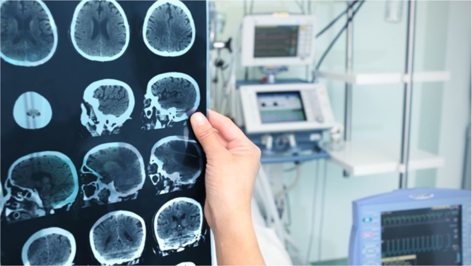 Evaluación de exámenes neuroimagenologicos